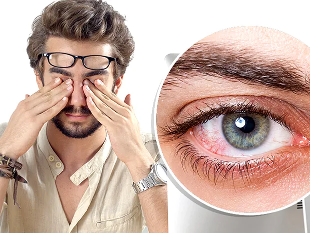 9 مورد از علت های اصلی پریدن پلک چشم 9 مورد از علت های اصلی پریدن پلک چشم