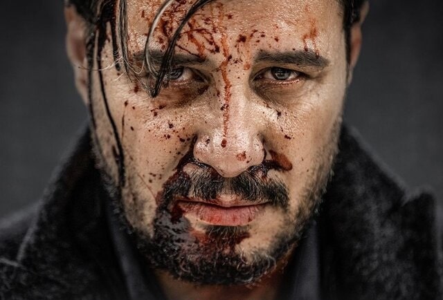  آغاز ساخت «زخم کاری ۲» با جواد عزتی