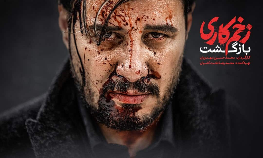 درباره سریال «زخم‌کاری؛ بازگشت یک کارِ زخمی