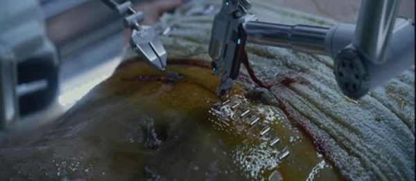 ۷. وقتی نومی راپاس در فیلم «پرومتئوس» (Prometheus) با دستگاه منگنه یک جراحی عذاب‌آور روی خودش انجام می‌دهد